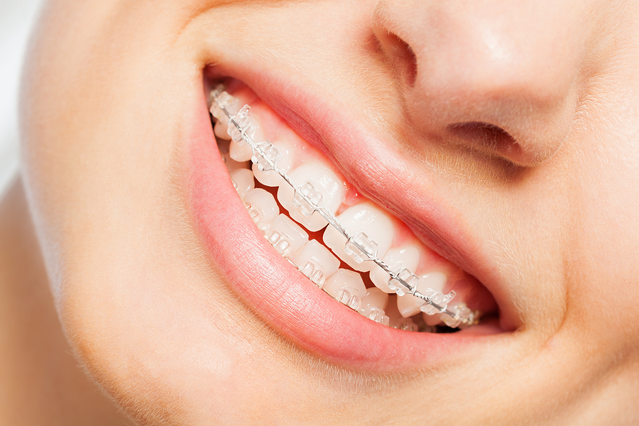 orthodontic issues